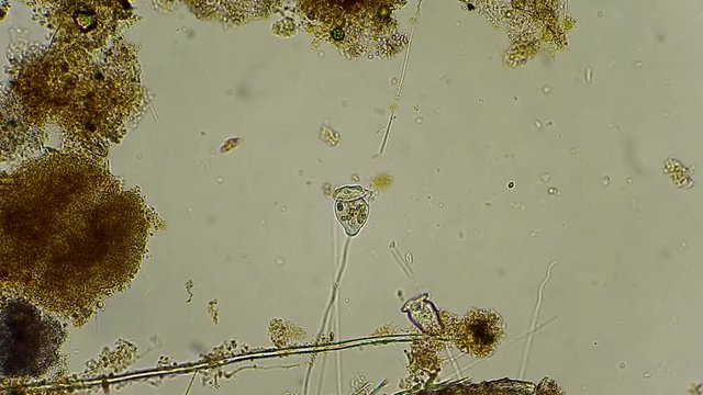 vorticella and rotifers filtrating water under microscope 