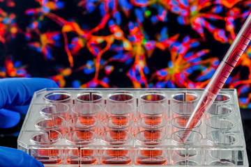 A 24 well tissue culture plate with a fluorescent cell image in the background