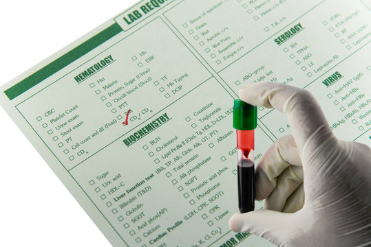 Chemistry and immunology blood requisition for CD4 in laboratory,Specimen in heparin tube blood collection,Green color blood sample collection tubes.(have clipping path)