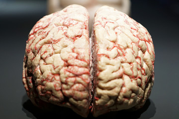 The human brain