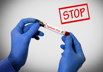 Stop papilloma virus