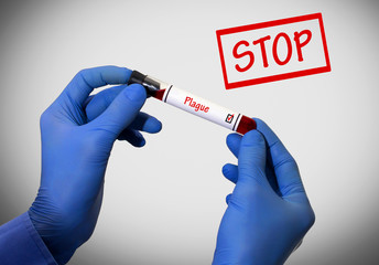 Stop plague