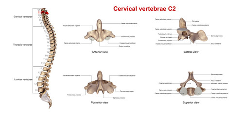 Cervical vertebrae C2_With Lables