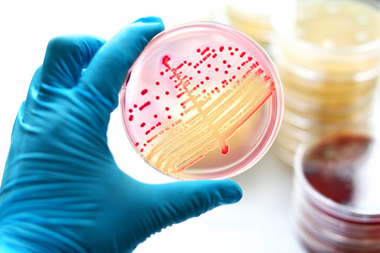 Colonies Of Bacteria In MacConkey Agar 
