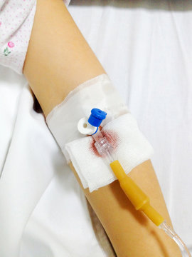  Transfusion
