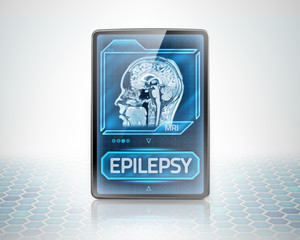 Epilepsy diagnosis shown on modern tablet