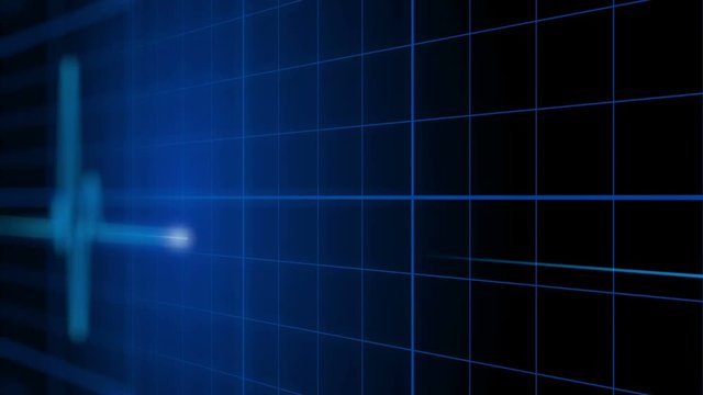 EKG 002: An electrocardiogram heart monitor pulses on a blue grid (Loop).