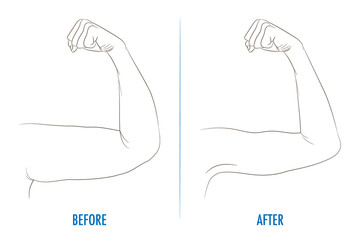 Female biceps before and after sport. Arms showing progress afte