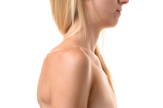 Collar bones of an undernourished woman