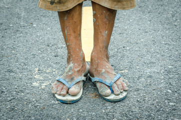 The feet of a old man who are in pain. And the hard work of the people.