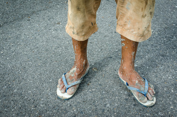 The feet of a old man who are in pain. And the hard work of the people.