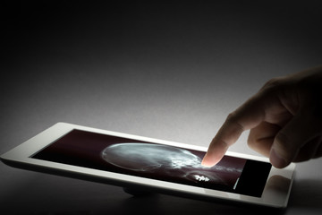 Human X-ray film exam by doctor