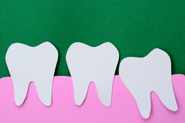 wisdom tooth