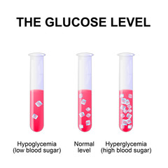  blood sugar level