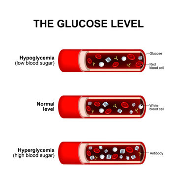 Glucose Level