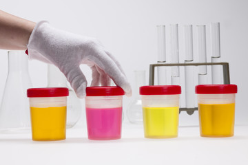 doping test of urine on laboratory