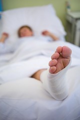 Patient with broken leg in a plaster cast