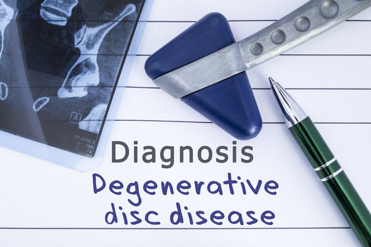 Diagnosis degenerative disc disease. Medical health history written with diagnosis of Lumbar disc disease, MRI image sacral spine and neurological hammer. Medical concept for Neurology, Neuroscience