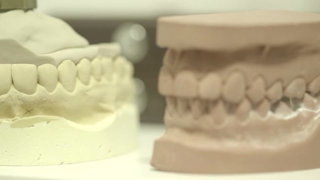 Camera pans between two types of teeth mould. 
(Filmed in ProRes with high dynamic range for flexibility for image grading)
