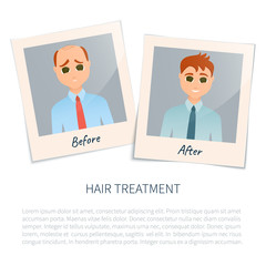 Vector illustration of two photographs of a man before and after hair treatment and hair transplantation. Male hair loss design template. Alopecia medical concept. Vector illustration.