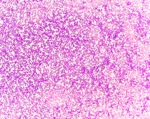 a precursor cell, also called a blast cell or simply blast, is a