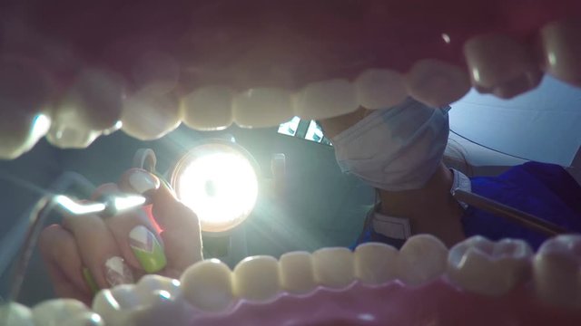 Treating teeth at the dentist
