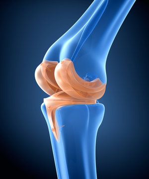 Knee and titanium hinge joint. X-ray view.  3D illustration
