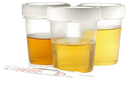 specimen cups for urinalysis with cocaine test stripes isolated on white background