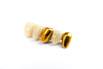 Dental ceramic and gold tooth crowns on white background. Isolated.