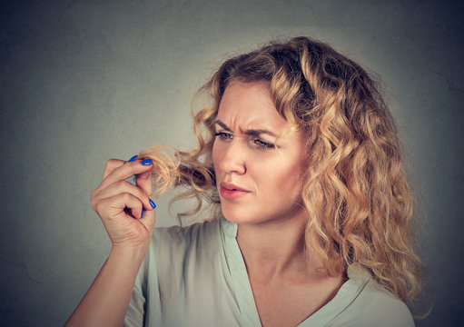 unhappy frustrated woman surprised she is losing hair receding hairline