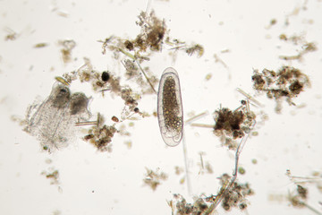 Freshwater unicellular microorganism. Zooplankton Super Macro