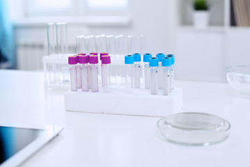 Research laboratory working space. Test tubes and tablet PC are lying at the table. Medical equipment. Blood test
