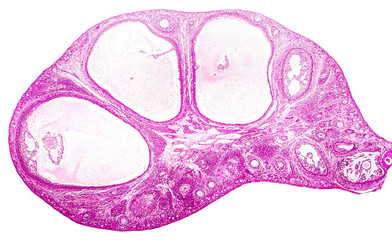 Transverse section of an ovary showing primordial, primary and secondary follicules. Light...