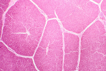 Light micrograph of a liver showing cords made from hepatocytes and clear space between them called hepatic sinusoids and filled with red blood cells. Magnification 40x