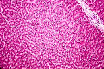 Light micrograph of a liver showing cords made from hepatocytes and clear spaces between them called hepatic sinusoids and filled with red blood cells. Magnification 200x