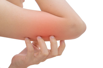 Woman has skin rash itch on arm