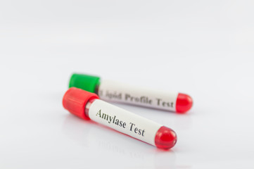 Test tubes collecting for medical laboratory on white background