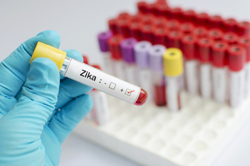 Fototapeta premium Blood sample positive with Zika virus