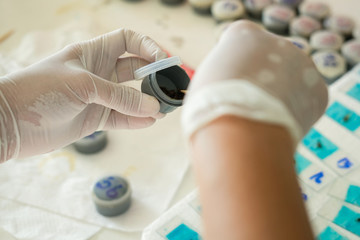 Stool analysis Stool examination Stool test