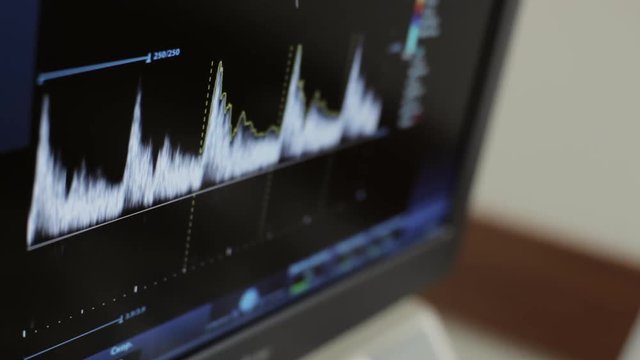 Ultrasonic scanner screen when doctor scanning neck of patient.