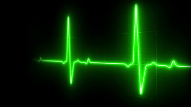 EKG Heart Line Footage Loop