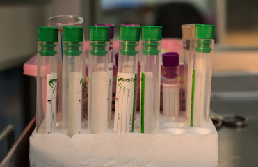 Bood test tubes in a foam tray at laboratory