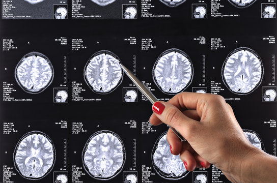 Obrazowanie metodą rezonansu magnetycznego 