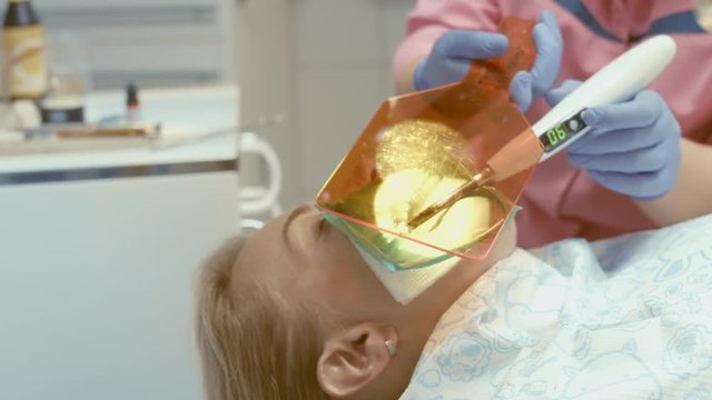 Dentist ultraviolet light illuminates the photopolymer filling