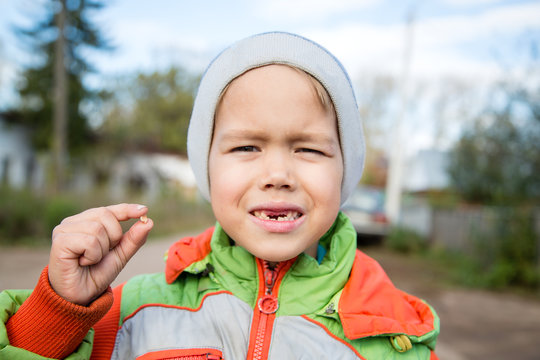 Little Boy Laughing With No Teeth Holding A Tooth