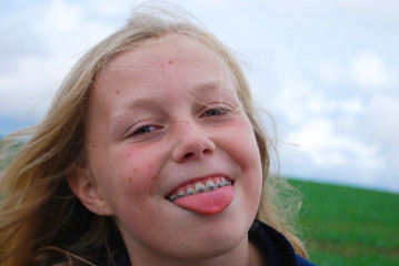 YOUNG BLOND CAUCASIAN GIRL WITH DENTAL BRACE SHOWS CHEEKY FACE AND TONGUE OUT