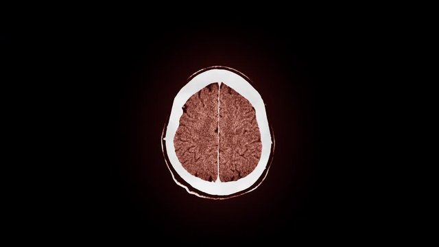 Human brain MRI scan. Top view. Smooth motion, brown tint.