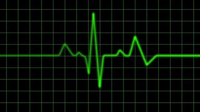 A 15 second loop of a Heart Monitor (EGK) with alpha matte to use over any background. HD 1080i.
