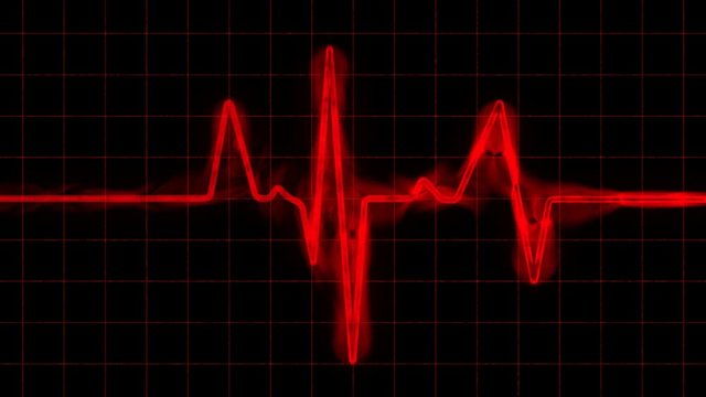A 15 second loop of a Red Grunge Heart Monitor (EGK) with alpha matte to use over any background. HD 1080i.