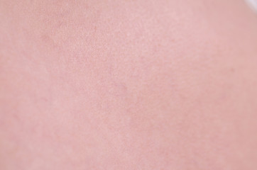 Fototapeta premium Blood vessels on woman leg, closeup.